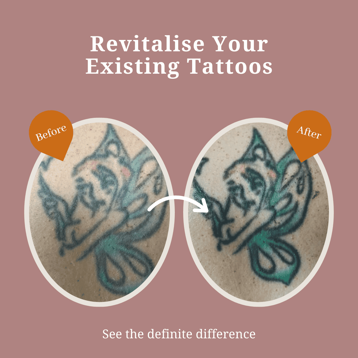 Tattoo RefreshINK: Revitalise Your Existing Tattoos